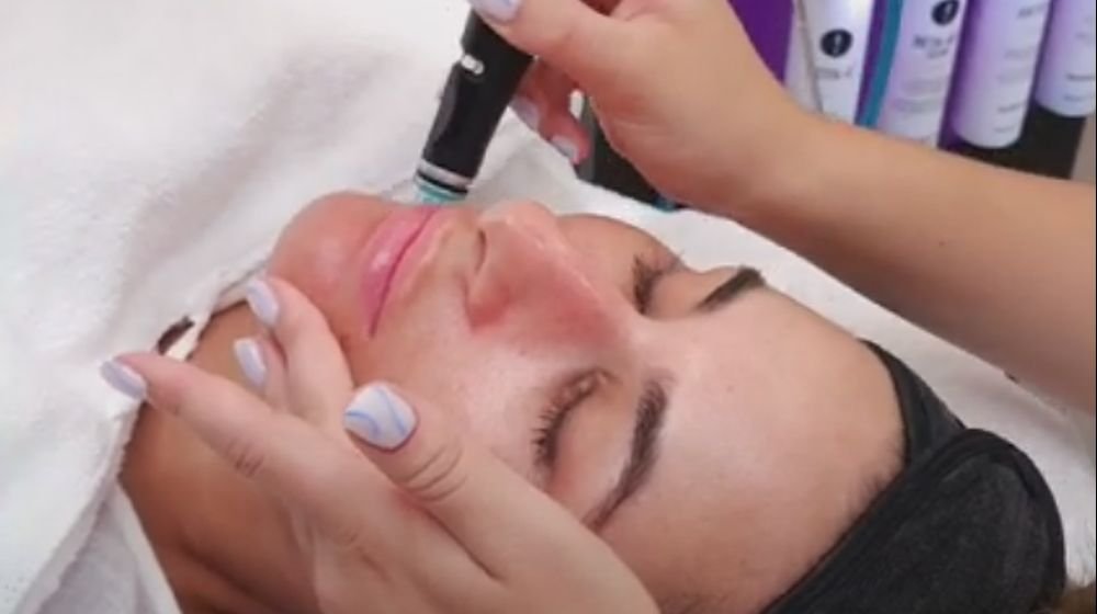 Ošetrenie pleti HydraFacial® Britenol - intenzívna hydratácia a rozjasnenie pleti